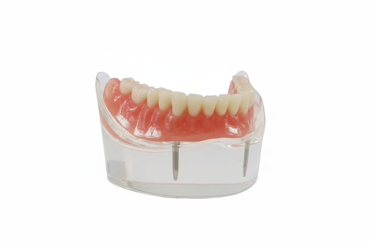 2 Implant Model